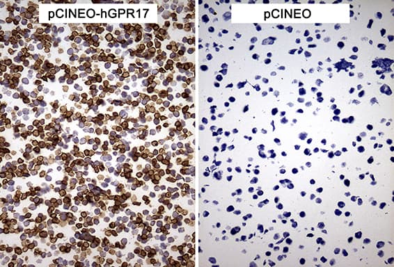 GPR17 Antibody (clone OTI18H2)