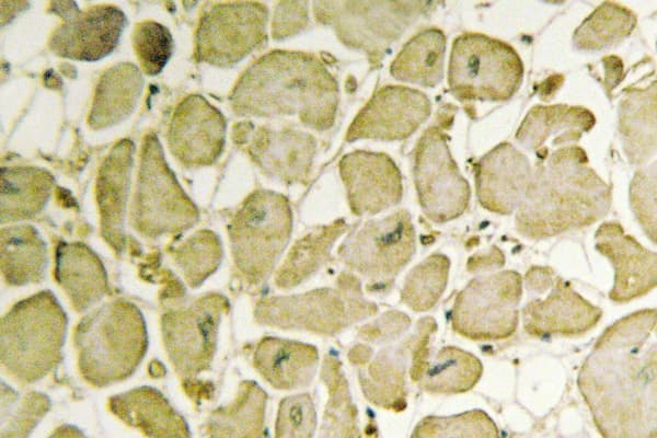 CYB5A / Cytochrome b5 Antibody (Gly82)