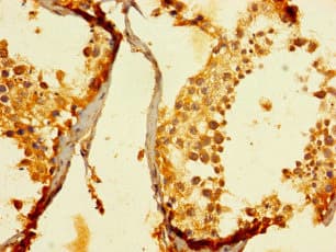 Polyclonal Rabbit anti-Human ENTPD3 Antibody
