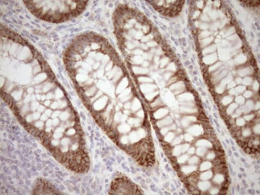EPLIN Antibody (aa1-275, clone OTI1B4)