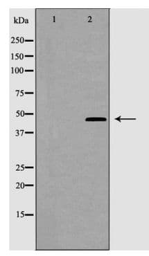 Polyclonal Rabbit anti-Human CRHR2 / CRF2 Receptor Antibody (IHC, WB)