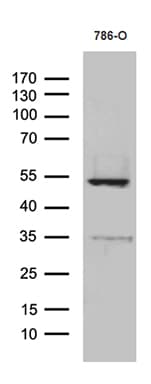 TNFSF10 / TRAIL Antibody (aa39-281, clone OTI9A8)