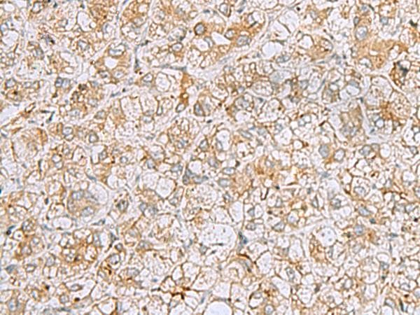 FERMT1 / Kindlin Antibody
