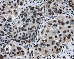 SORD / Sorbitol Dehydrogenase Antibody (clone OTI15H2)