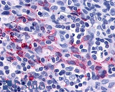 IHC-plus™ Polyclonal Rabbit anti-Human P2RY11 / P2Y11 Antibody (Extracellular Domain, IHC)