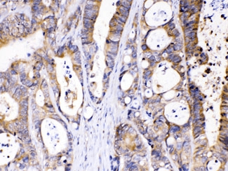 Polyclonal Rabbit anti-Human ABHD5 Antibody (IHC, WB)
