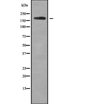 ROBO1 Antibody