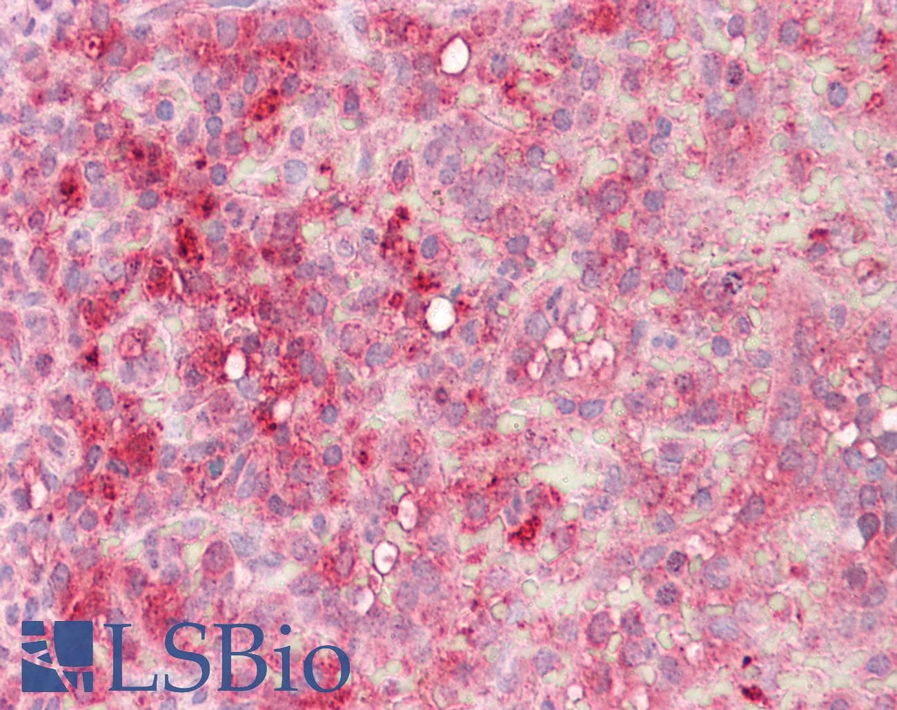 IHC-plus™ Polyclonal Rabbit anti-Human TUBG1 / Tubulin Gamma 1 Antibody (aa386-435, IHC, WB)