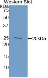 SPON1 / F-Spondin Antibody (aa597-801, Biotin)