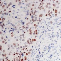 MYC / c-Myc Antibody (C-Terminus)