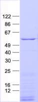 Human DES / Desmin Protein (Recombinant His, N-Terminal)