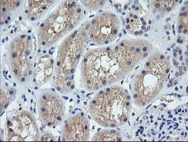 CTAG1B / NY-ESO-1 Antibody (clone OTI1C4, Carrier-free)