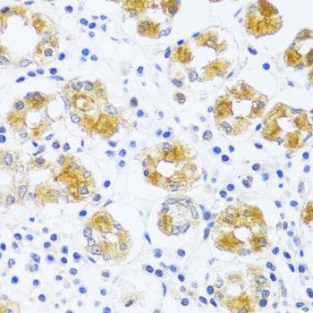 C3orf10 Antibody