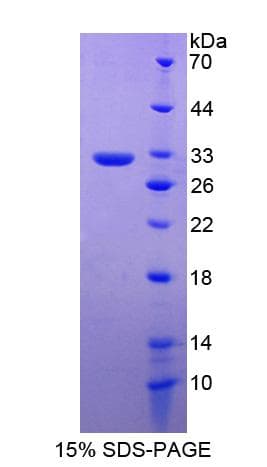 Human RGS19 Protein (Recombinant His-S)
