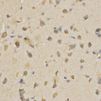 IHC-plus™ Polyclonal Rabbit anti-Human CDC34 Antibody (IHC, IF, WB)