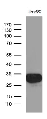 M-PST / STM Antibody (clone OTI1C6)