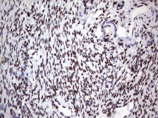 DDX56 Antibody (aa323-547, clone UMAB152)