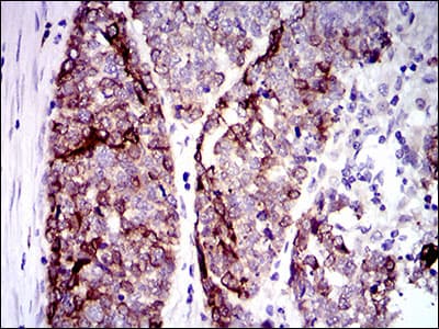 KRT5 / CK5 / Cytokeratin 5 Antibody (aa316-590, clone 10C11E6)
