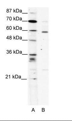 PDLIM5 / LIM Antibody (aa165-214)