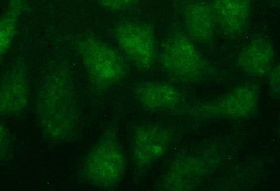 FGG / Fibrinogen Gamma Antibody (clone OTI1F5, Carrier-free)