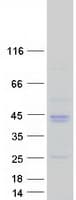 Human Osteoglycin / Mimecan Protein (Recombinant Myc-DDK (Flag))