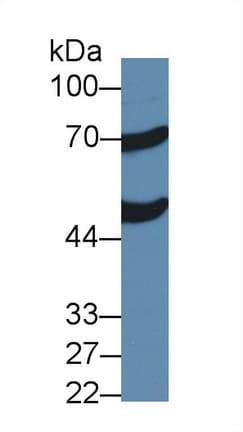 ACOX1 / ACOX Antibody