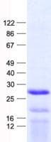 Human UBE2E3 Protein (Recombinant His, N-Terminal)