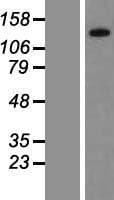 PPP1R3A / GM Protein (Over-Expression Lysate Myc-DDK (Flag))