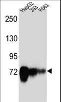 Polyclonal Rabbit anti-Human CDH22 / Cadherin 22 Antibody (aa411-440, IHC, WB)