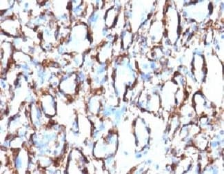 ACTA2 / Smooth Muscle Actin Antibody (clone ACTA2/791, Ready-to-Use)