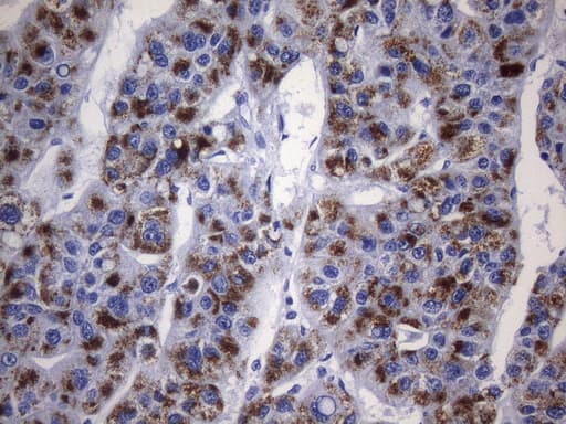 AMACR / P504S Antibody (clone UMAB214)