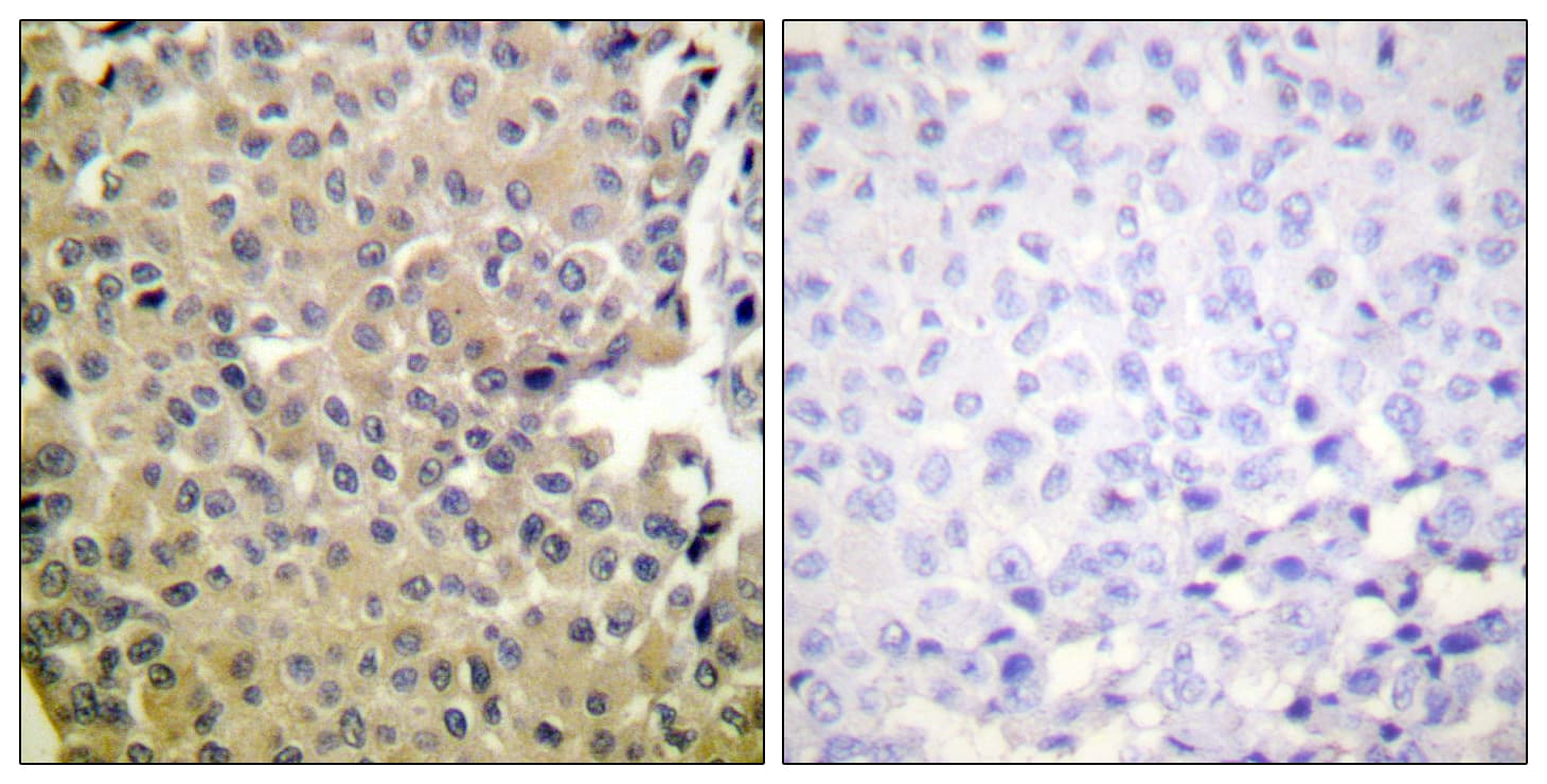 Polyclonal Rabbit anti-Human PPP1CA / PP1-Alpha Antibody (phospho-Thr320, IHC)