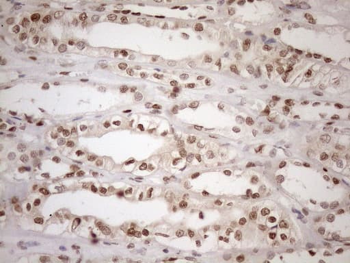 MGMT Antibody (clone OTI2E2)