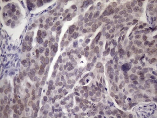 PDIA6 / ERP5 Antibody (clone OTI3E9)
