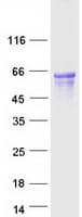 Human GPR141 Protein (Recombinant Myc-DDK (Flag))