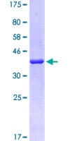 Human FAM229B / C6orf225 Protein (Recombinant GST)