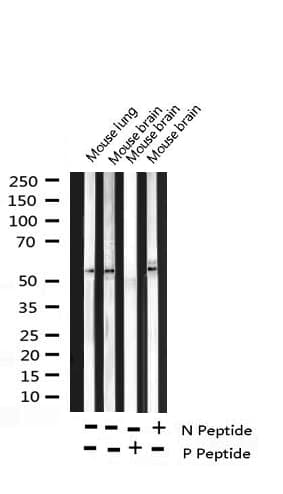 Polyclonal Rabbit anti-Human RPS6KB2 / S6K2 Antibody (phospho-Ser423, IF, WB)
