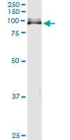 ITGB8 / Integrin Beta 8 Antibody (clone 2B4)