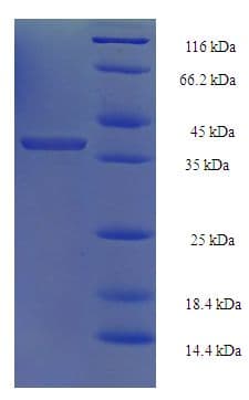 Human PSMD10 / Gankyrin Protein (Recombinant His-SUMO)