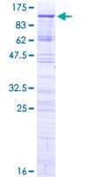 Human PHACTR2 Protein (Recombinant GST)