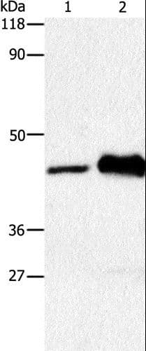 Polyclonal Rabbit anti-Human HTR1A / 5-HT1A Receptor Antibody (IHC, WB)