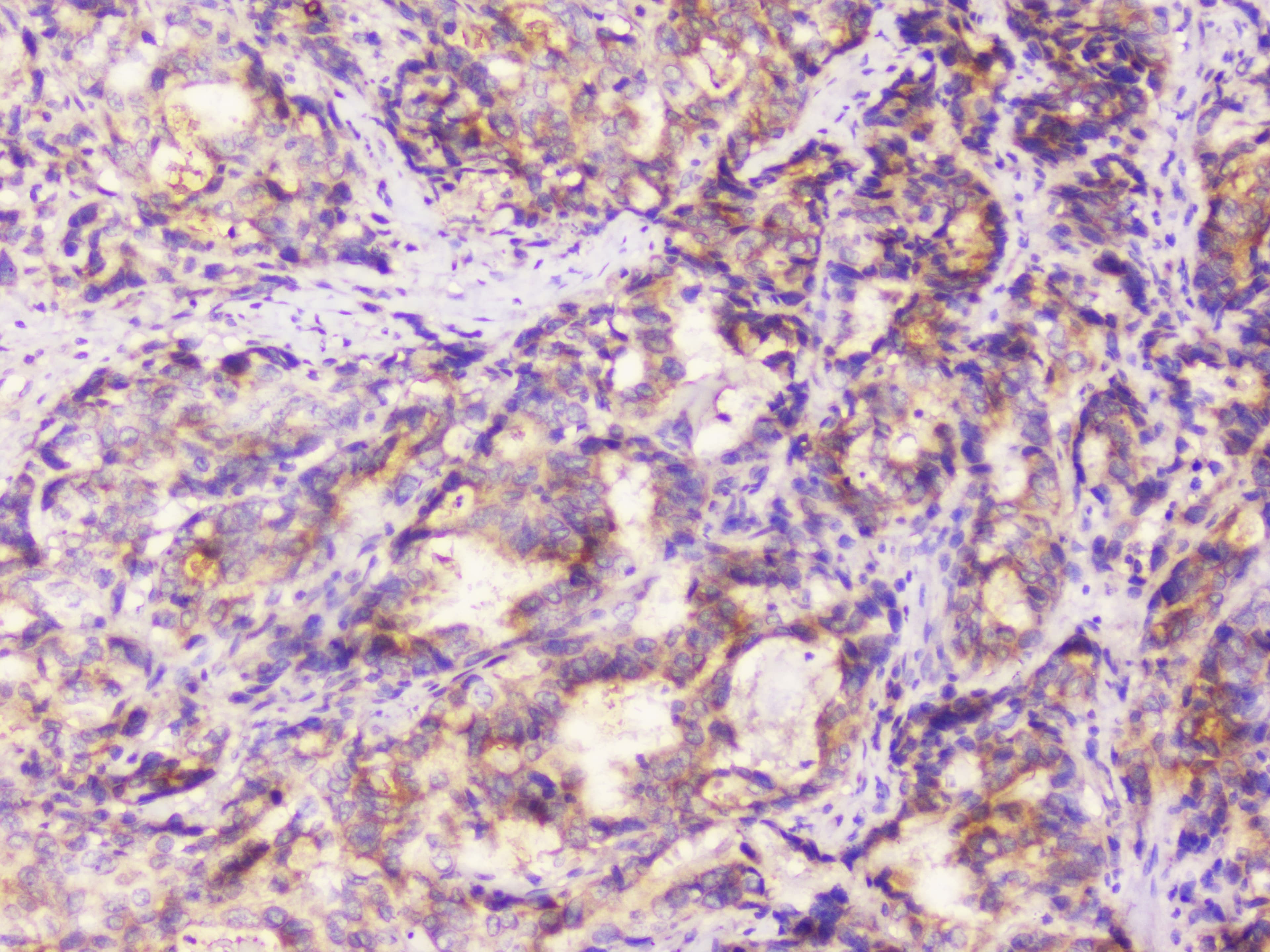 Polyclonal Rabbit anti-Human EML4 Antibody (IHC, WB)