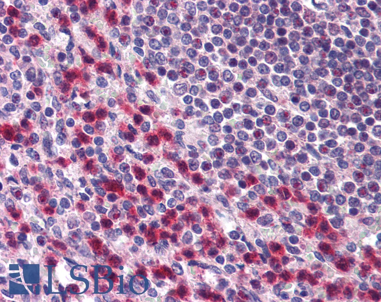 IHC-plus™ Polyclonal Rabbit anti-Human BTF / BCLAF1 Antibody (aa700-750, IHC, WB)