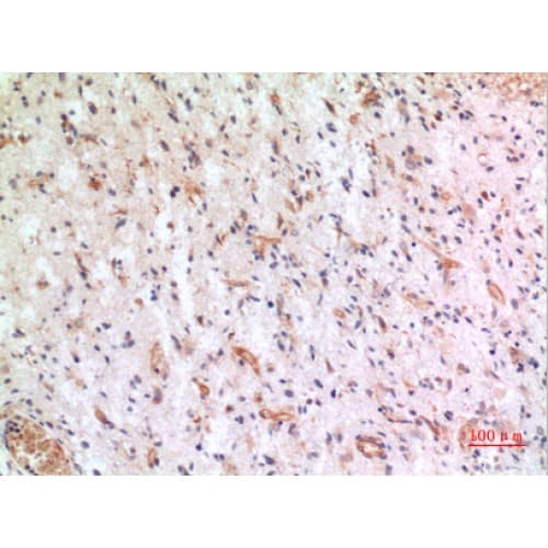 CX3CL1 / Fractalkine Antibody (221-270 aa, Internal)