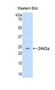 AGR2 Antibody (aa21-175, APC)