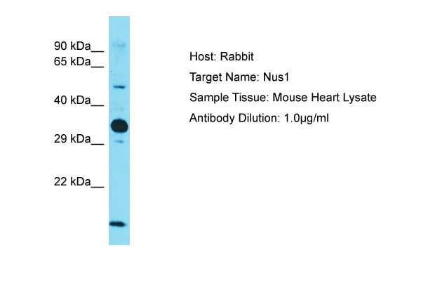 Polyclonal Rabbit anti-Mouse NUS1 Antibody (aa151-200, WB)