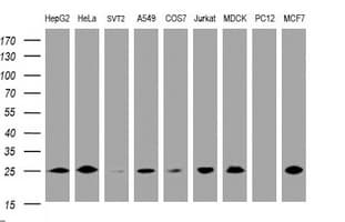 CMPK / CMPK1 Antibody (clone OTI2A2)
