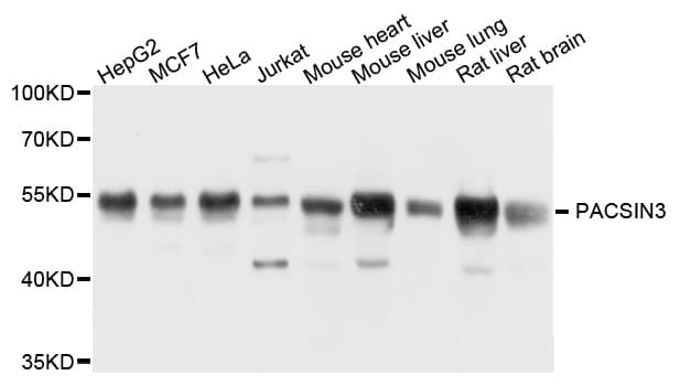 PACSIN3 Antibody