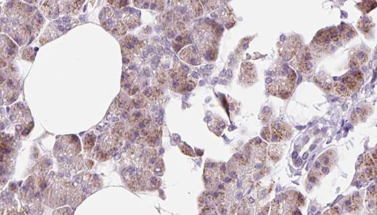Polyclonal Rabbit anti-Human DCTN6 / Dynactin 6 Antibody (IHC, IF, WB)