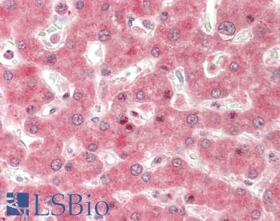 IHC-plus™ GMDS / GMD Antibody (clone 2A1)